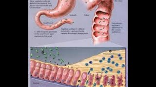 Clostridium Difficile [upl. by Hedgcock]