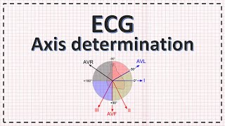 Cardiac Axis Determination  ECG Axis  Simplified [upl. by Ikcin]