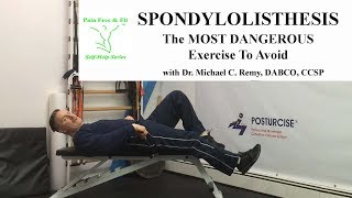 Spondylolisthesis The Most Dangerous Exercise To Avoid [upl. by Lorac]