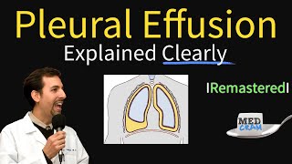 Pleural Effusions  Causes Diagnosis Symptoms Treatment [upl. by Rosemonde]