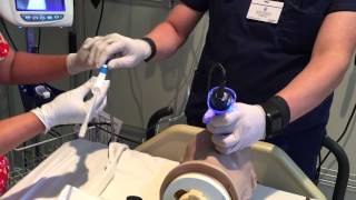 GlideScope Intubation Assist [upl. by Natassia53]