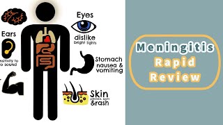 Meningitis Rapid Review [upl. by Hinckley]