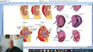 Ischemia reperfusion injury and cardioprotection [upl. by Tanberg]