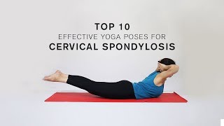 Top 10 Effective Yoga Poses for Cervical Spondylosis [upl. by Luaped848]