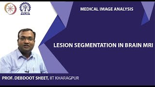 Lesion segmentation in Brain MRI [upl. by Ahsatak]