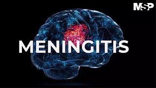 Meningitis [upl. by Ahsenot]