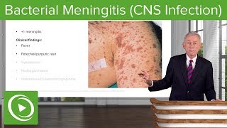 Bacterial Meningitis CNS Infection – Infectious Diseases  Lecturio [upl. by Llertram]