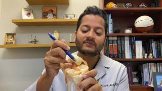 Medial Meniscus Root tear Educational Video [upl. by Alaric]