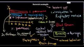 Bacterial meningitis [upl. by Guerra]