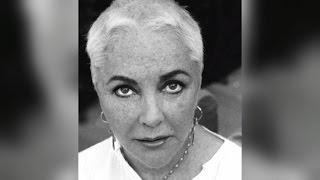 See Intimate Photos of Elizabeth Taylor After She Had Brain Tumor Removed [upl. by Yadseut]